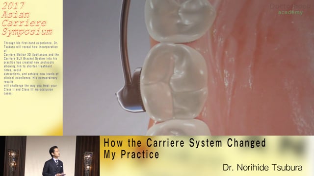 How the Carriere System Changed My Practice【Digest】