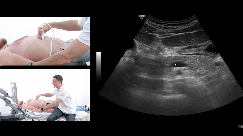 Pancreas Ultrasound