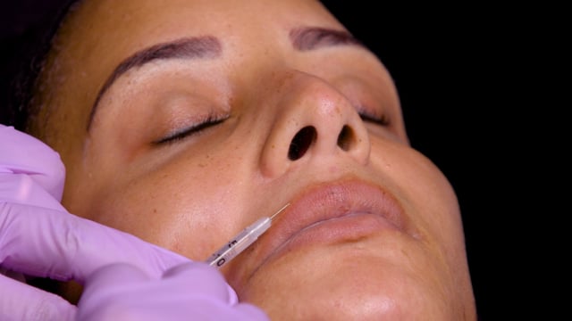 Full Face Beautification Injections - 