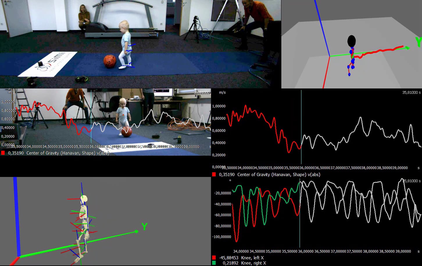 Toddler Gait Analysis - Markerless Motion Analysis On Vimeo