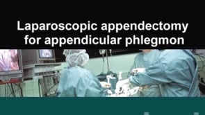 Laparoscopic Appendectomy For Appendicular Phlegmon | WebSurg, The ...