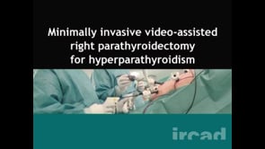 minimally invasive parathyroidectomy