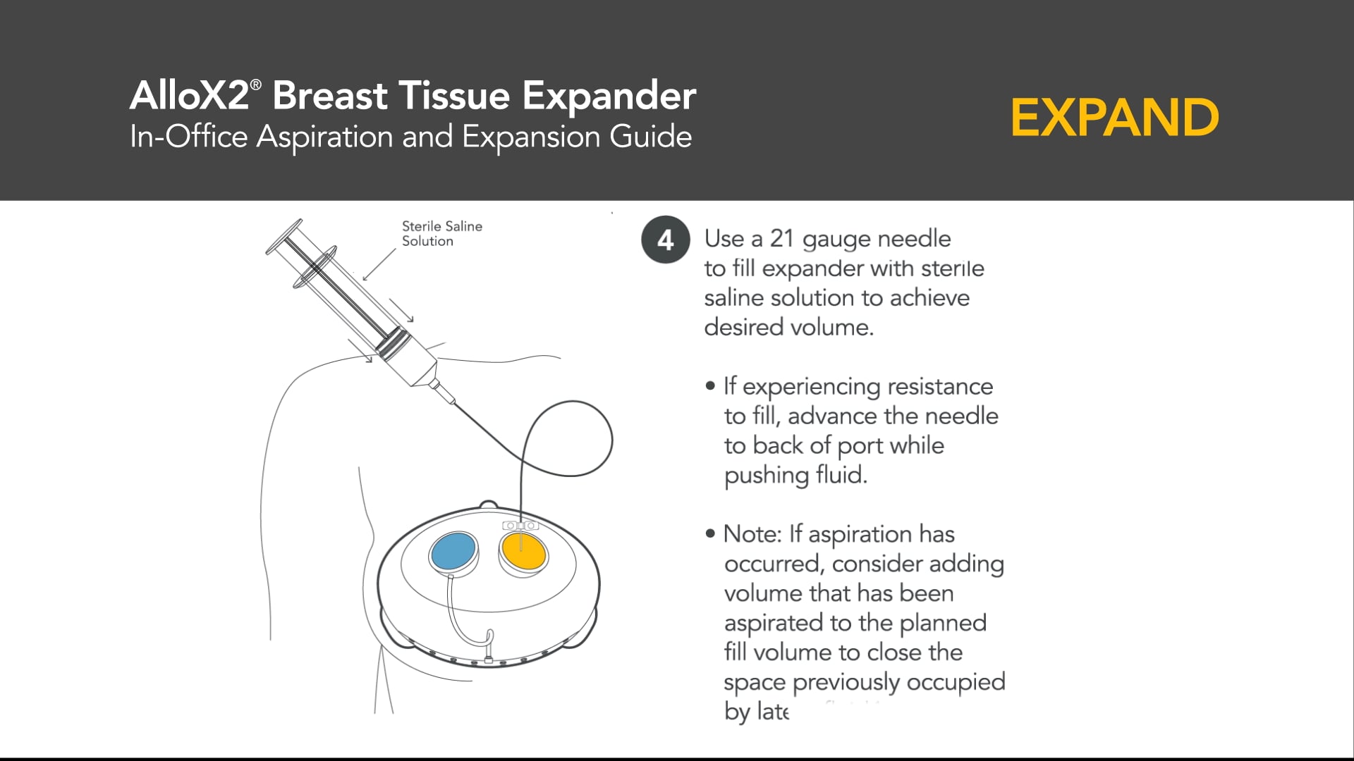 Sientra AlloX2(R) Breast Tissue Expander - In Office Expansion Guide