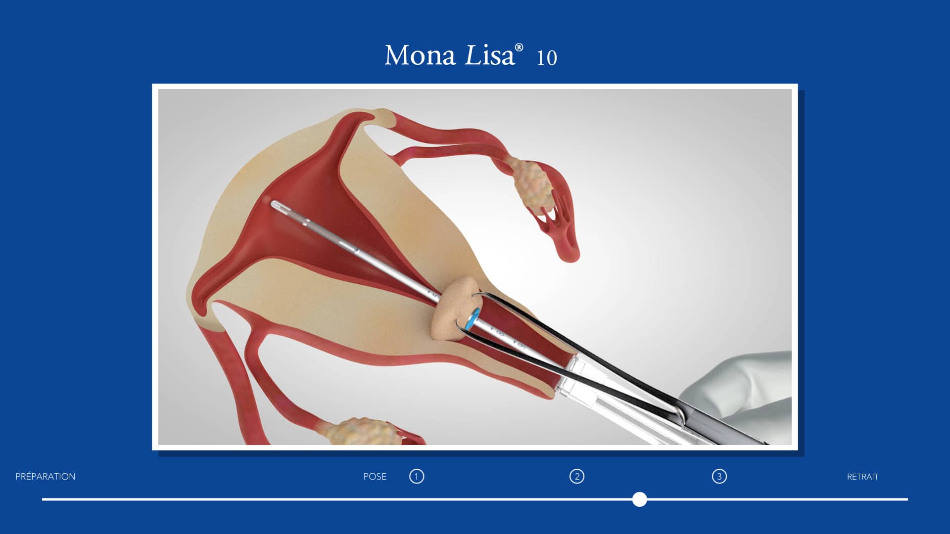 009 cut 380a ql fr on vimeo