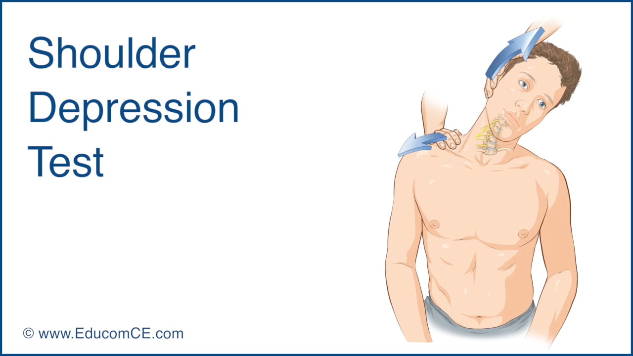 US-Shoulder Depression Test-Video-2017-Vimeo on Vimeo