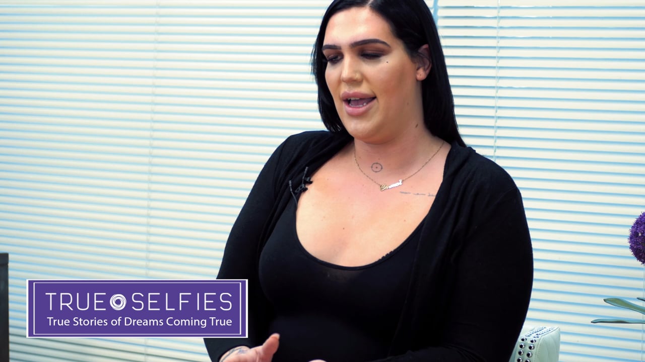 Carmen's TrueSelfie Journey with Rhinoplasty, Subnasal Lip Lift, Frontal Bossing, Mandibular Reshaping and Breast Augmentation T