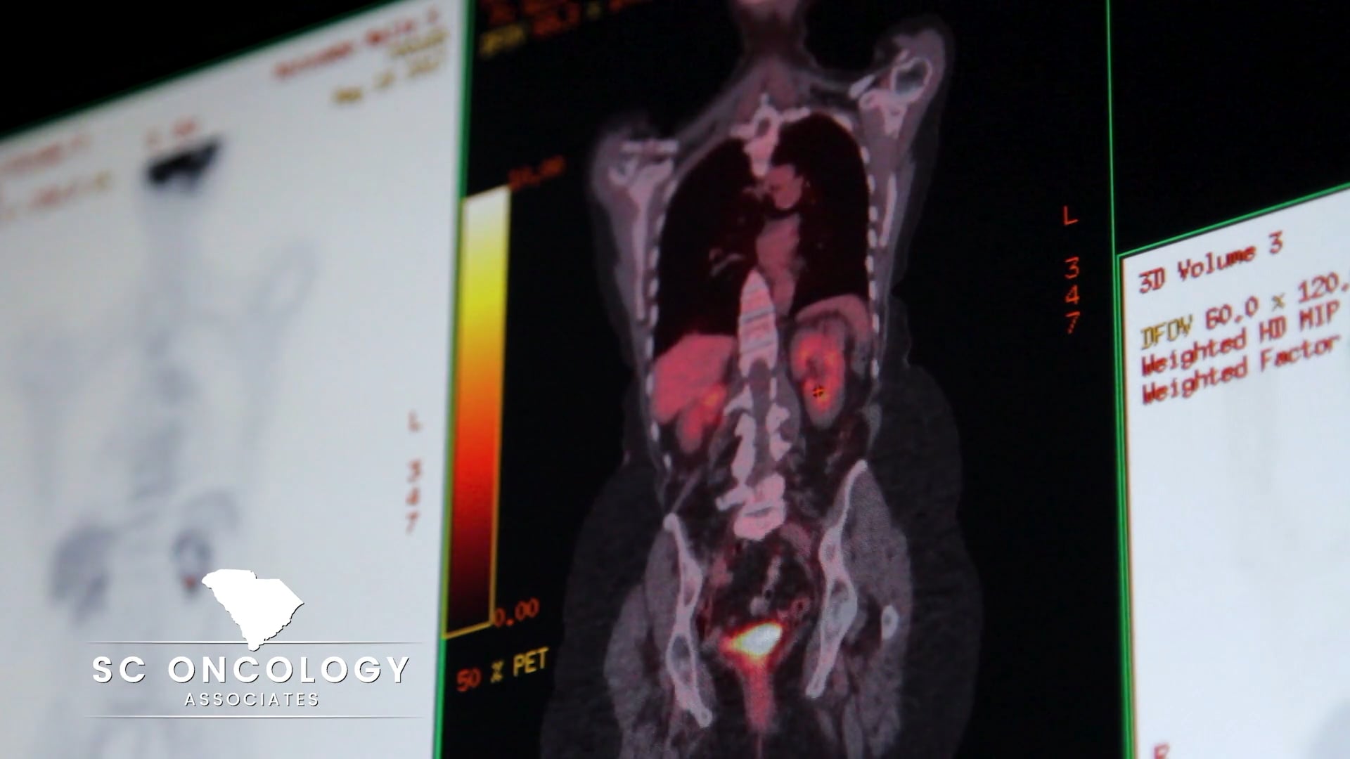 SC Oncology - SCOA | Diagnostic Imaging on Vimeo