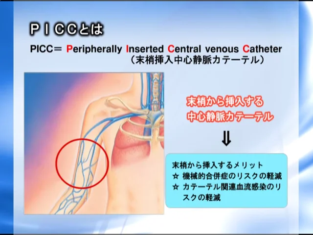 1．PICCの概要