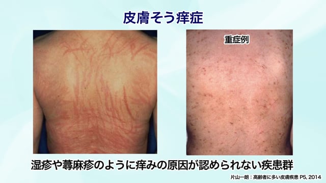 【裁断済み】 誤診されている皮膚疾患 全ての診療科で役立つ皮膚診療のコツ―これだけは知っておきたい