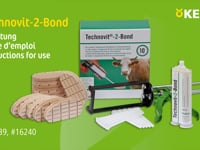 http://www.kerbl.de/artikel/16239  Technovit-2-Bond &amp;ndash; Der schnelle 2-Komponenten-PU-Klebstoff zur Klauenbehandlung!   Technovit-2-Bond ist ein schnelltrocknender&amp;hellip;