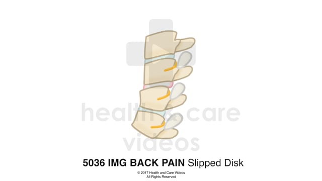 HCV Clip library Animation & Assets on Vimeo