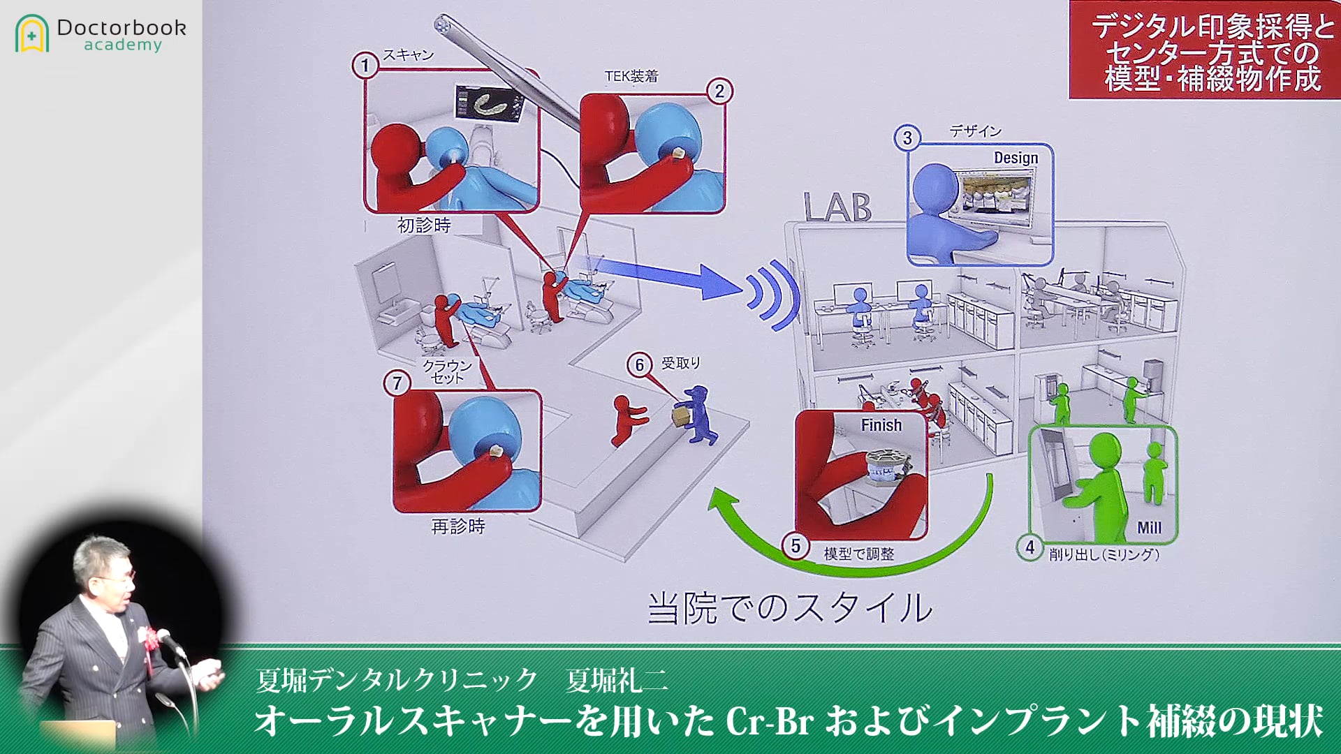 オーラルスキャナーを用いたCr-Brおよびインプラント補綴の現状