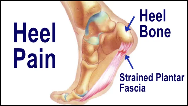 Tendon sales under heel