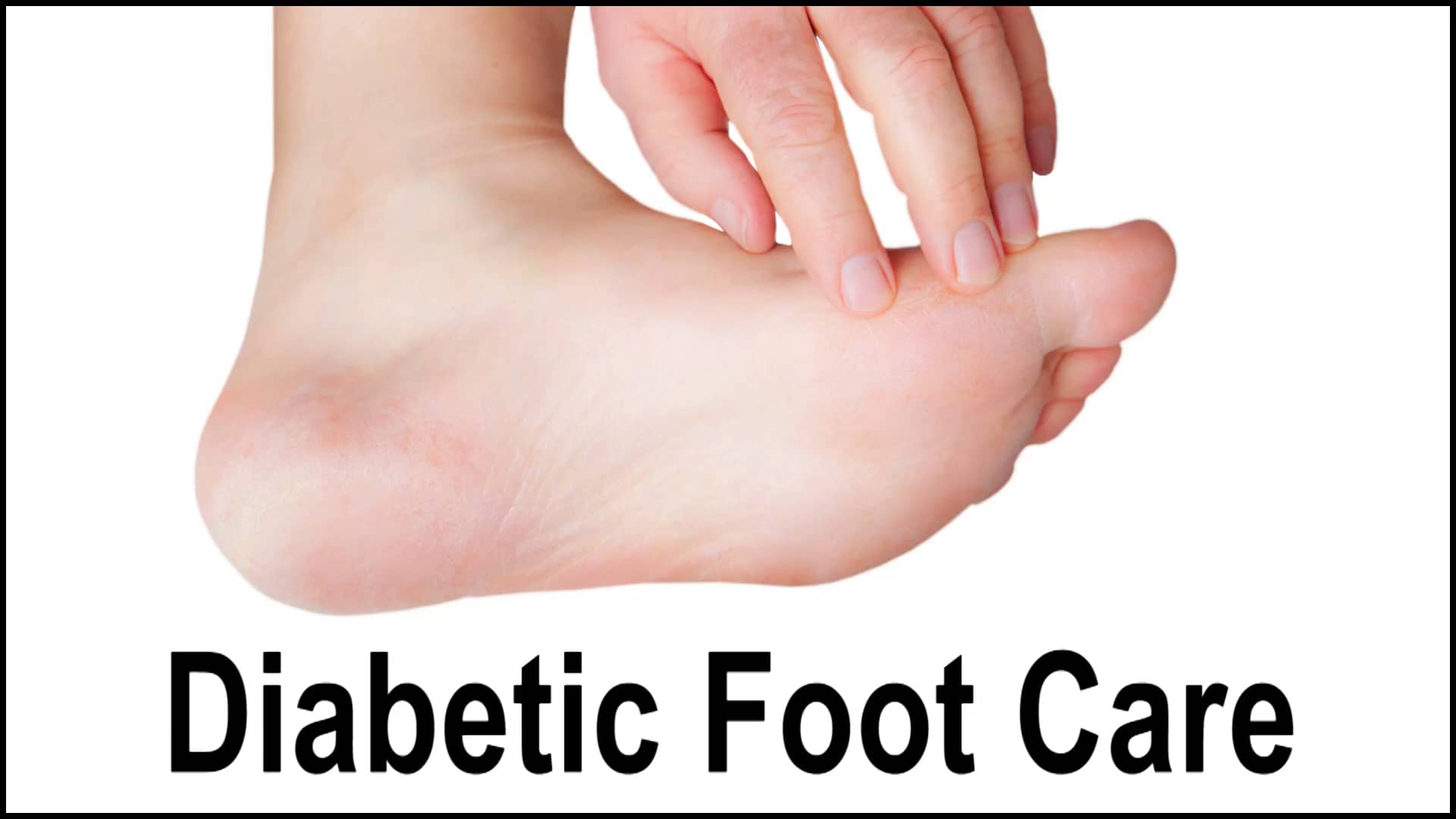 Diabetic Foot Care- Podiatrists in Waterbury & Newtown, CT, Performance ...