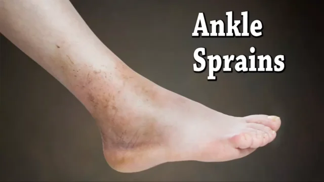 Don't Spiral into an Ankle Sprain — Valley Stream Podiatry