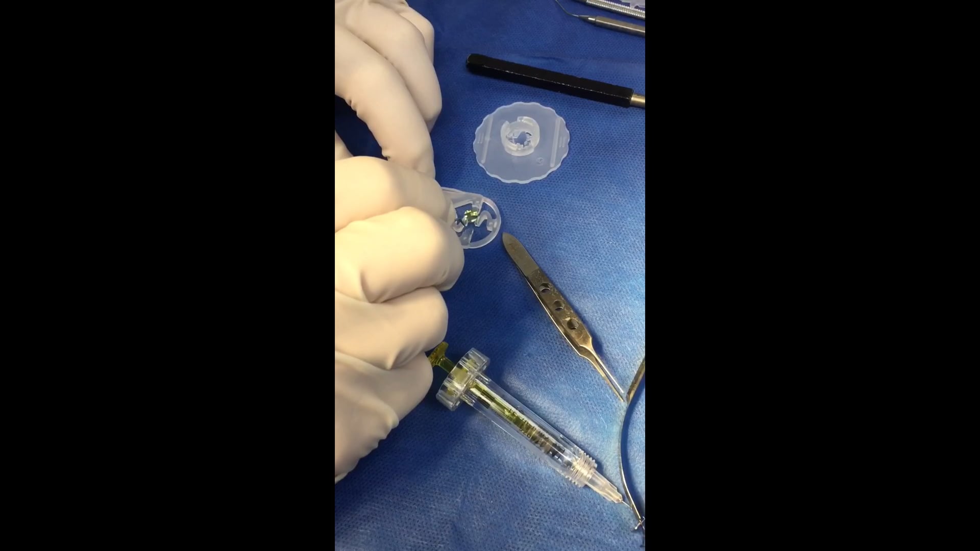 Sulcus intraocular lens implantation on Vimeo