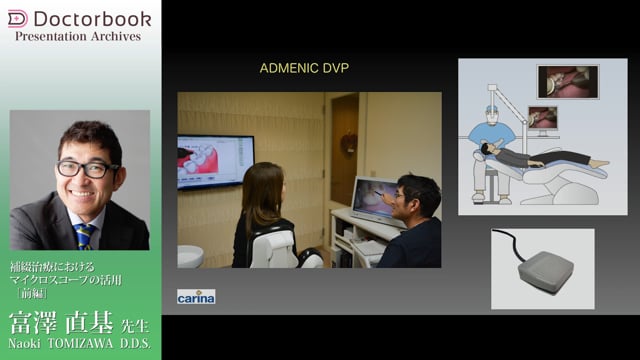 補綴治療におけるマイクロスコープの活用（前編）