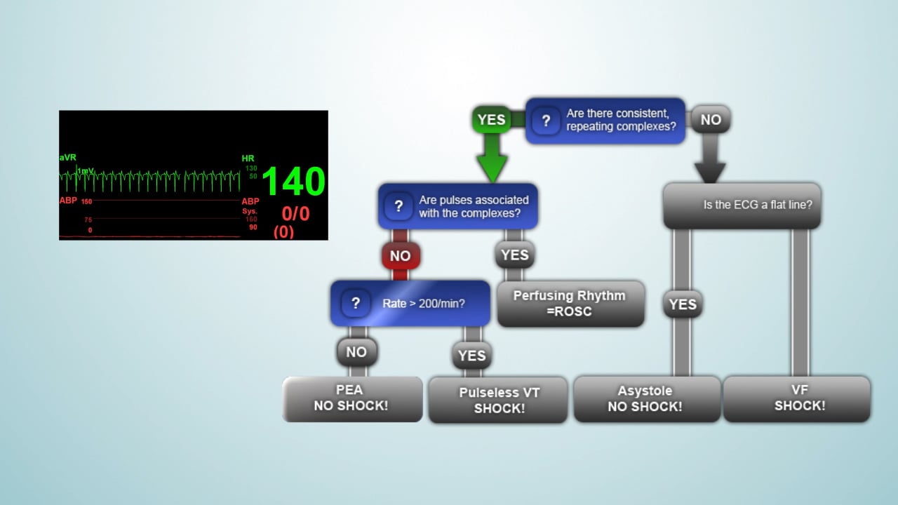 ALS Module 2 legacy - ECG Rhythm Diagnosis Algorithm: In Action ...