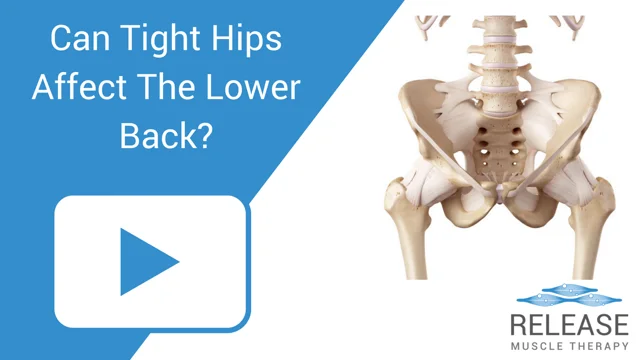 Tight hips back pain hot sale