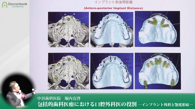 包括的歯科医療における口腔外科医の役割