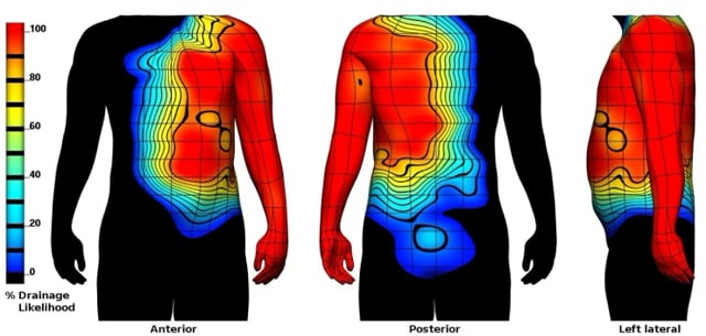 The heat map and skin selection tool — Science Learning Hub
