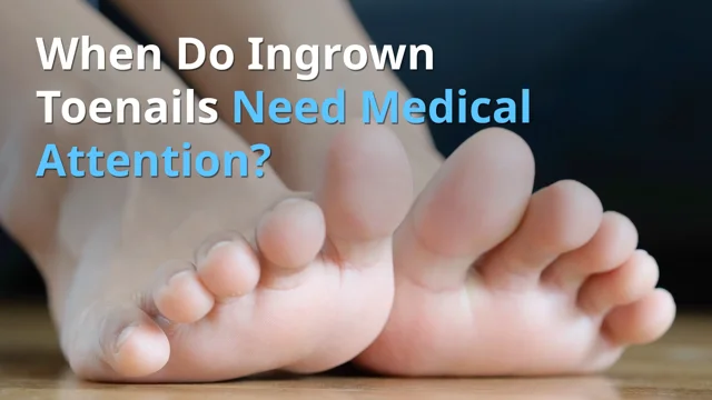 Identifying When Your Ingrown Toenail Requires Medical Attention - Century  Medical & Dental Center