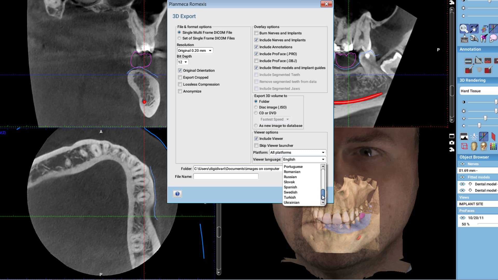 Planmeca romexis viewer недостаточно памяти для открытия 3d объема