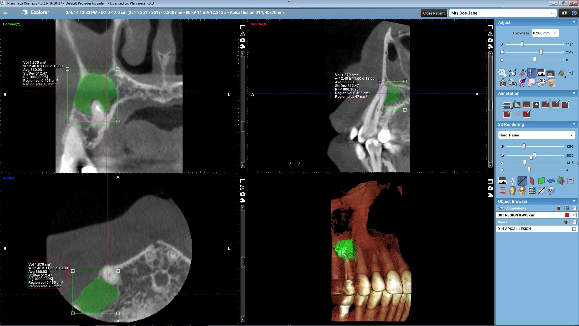 Planmeca romexis viewer. Кт planmeca promax 3d. planmeca romexis. кт планмека инструкция. romexis generate cache.