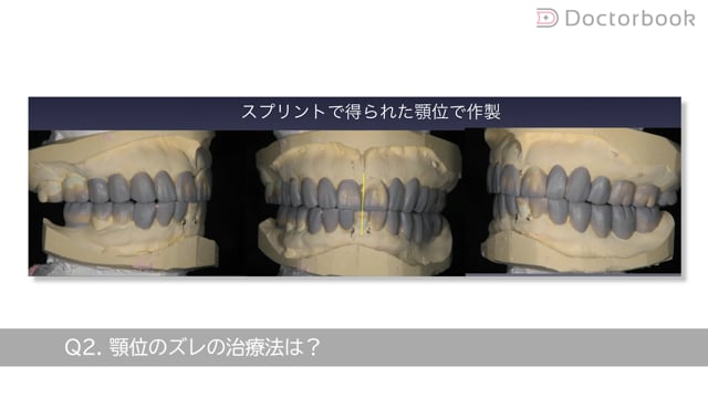 顎関節症の治療