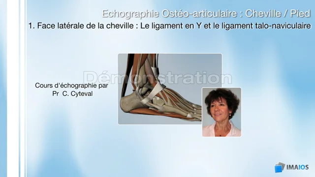 Echographie des ligaments en Y et talo naviculaire Demo