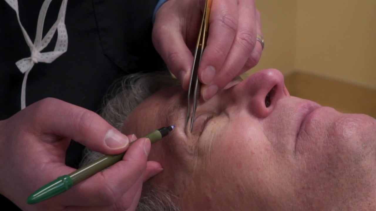 EYELIDS The Experience Jerry
