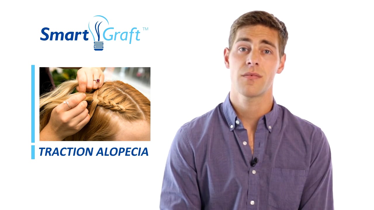 What Causes Hair Loss