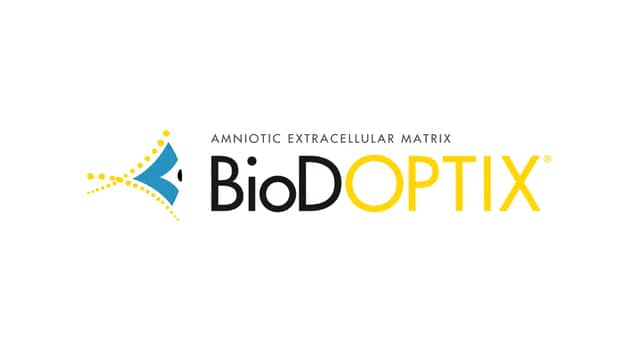 BioDOptix® Filamentary Keratitis on Vimeo