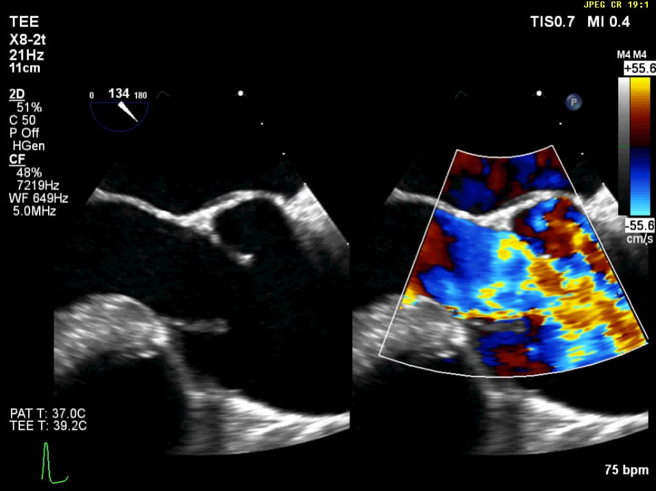 Case 2 echo 2 on Vimeo
