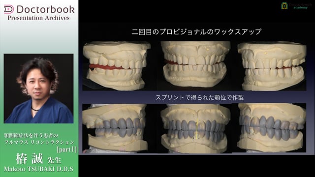 顎関節症状を伴う患者のフルマウス リコントラクション