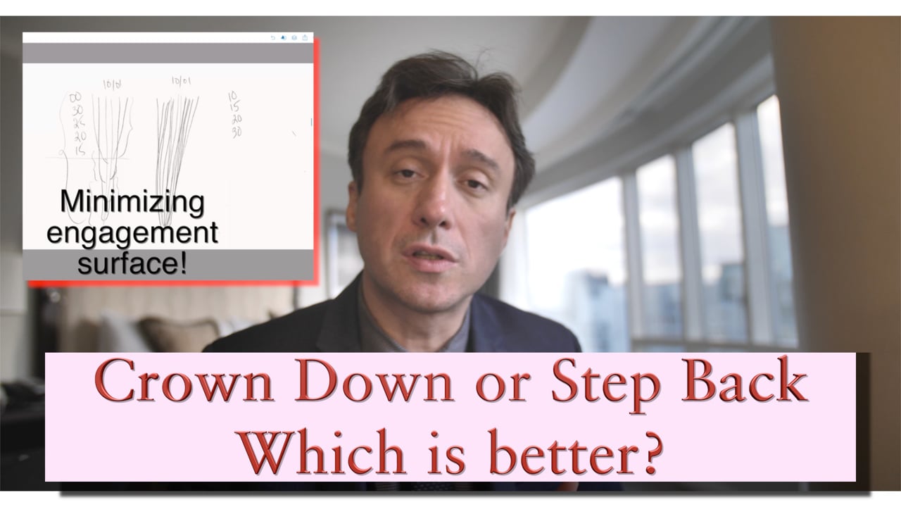 Crown Down or Step Back, Which is Better? Real World Endo