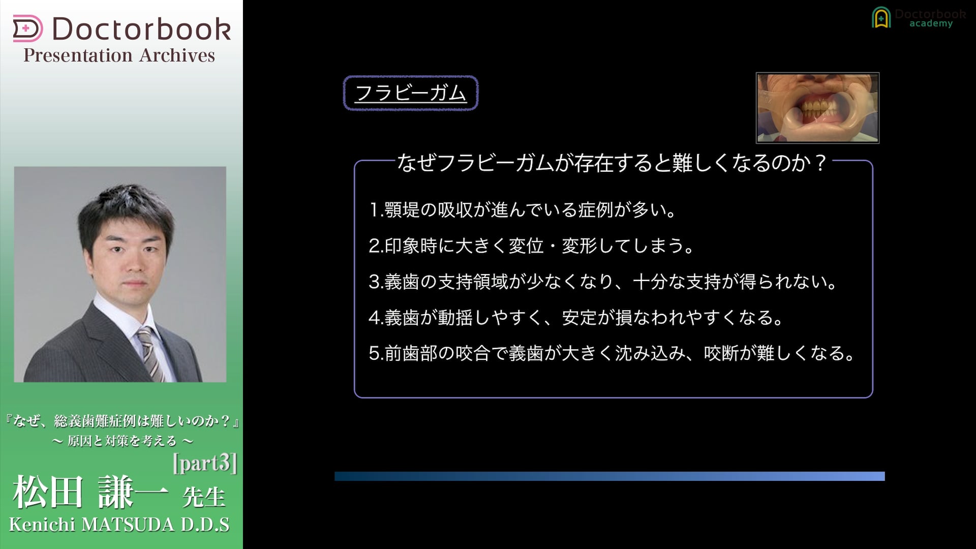 #3 代表的な難症例とその対応例とは？フラビーガム