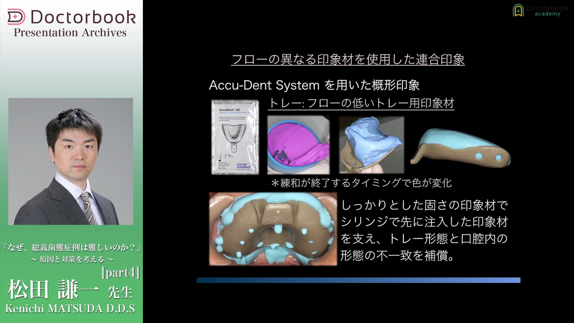 #4 代表的な難症例とその対応例とは？高度顎堤吸収