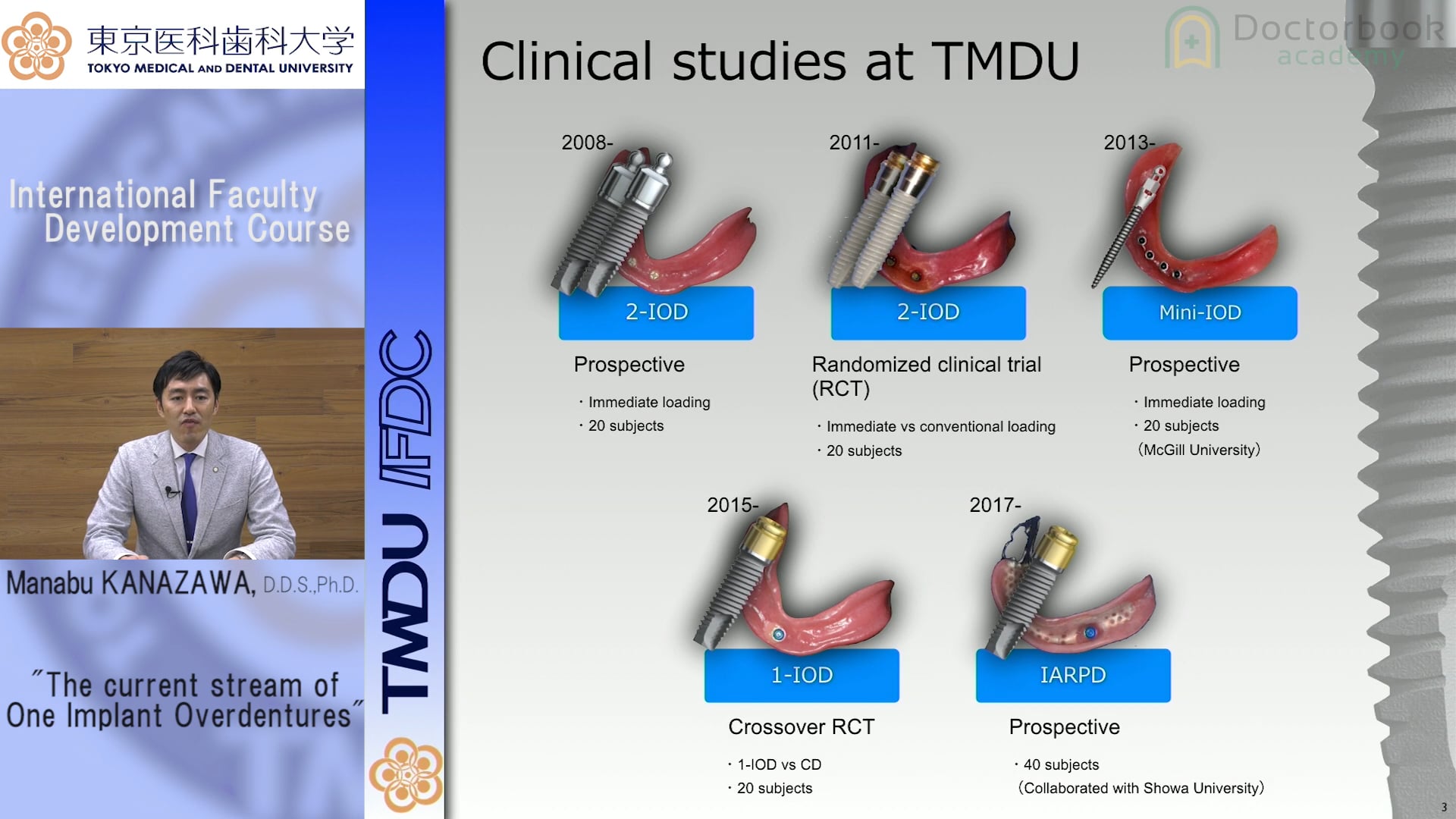 Manabu Kanazawa DDS Ph.D：The current stream of One Implant Overdentures