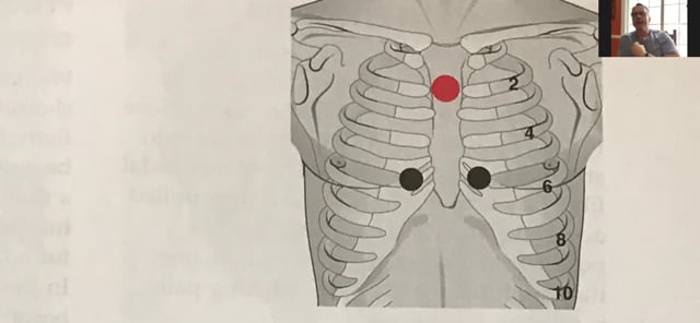  Infraspinatus Reset