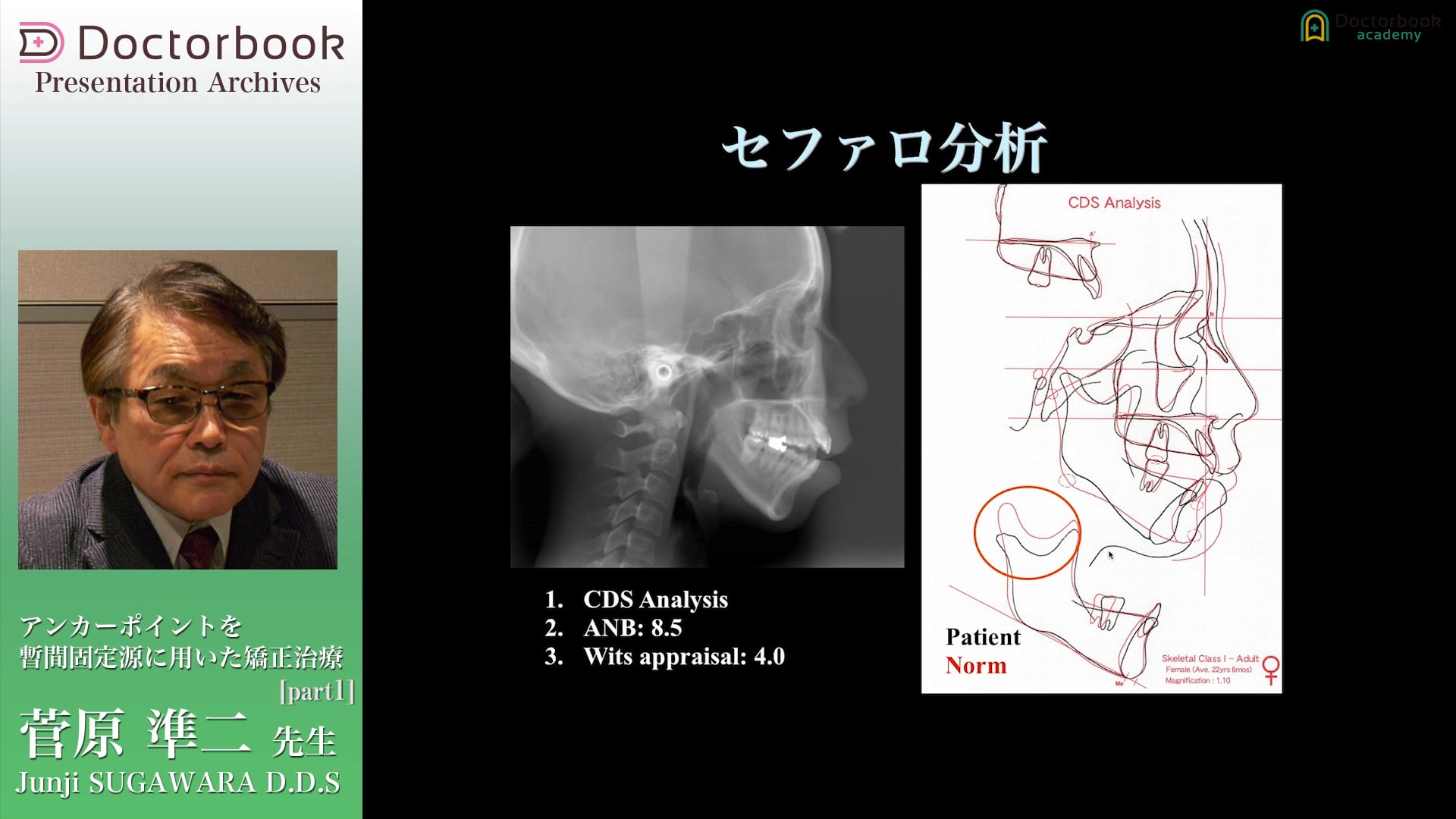 X線解剖学とセファロ分析法 - 健康/医学