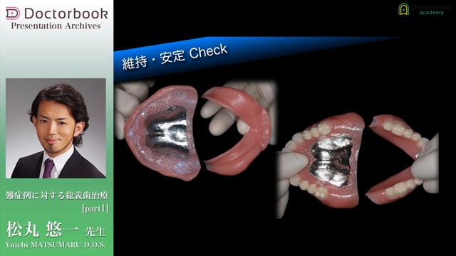 #1 治療用義歯のコンセプト