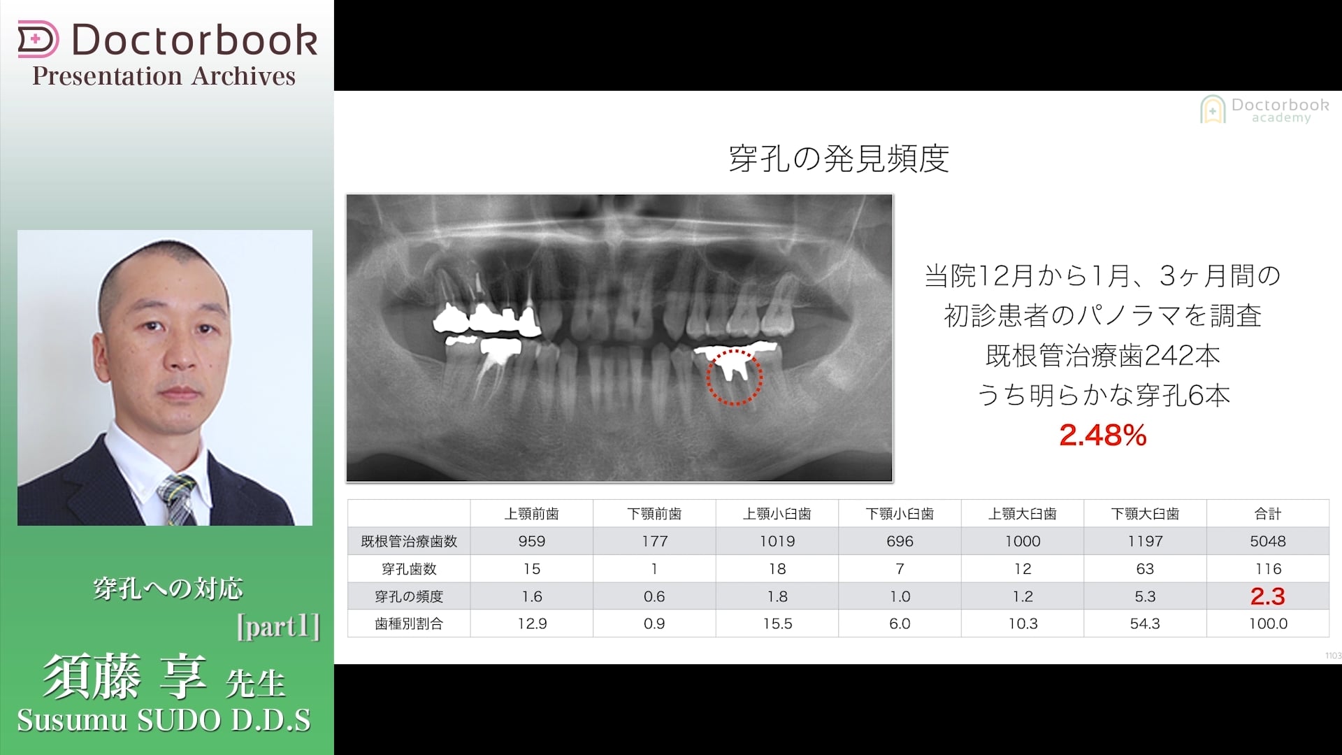 #1 穿孔の発見頻度