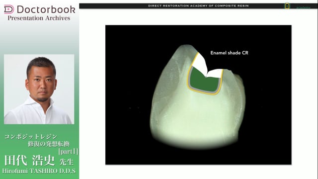 コンポジットレジン修復の発想転換 | Doctorbook academy (ドクター