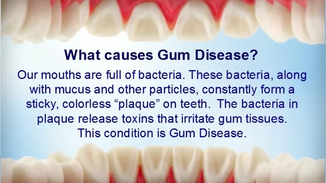 What Causes Gum Disease?