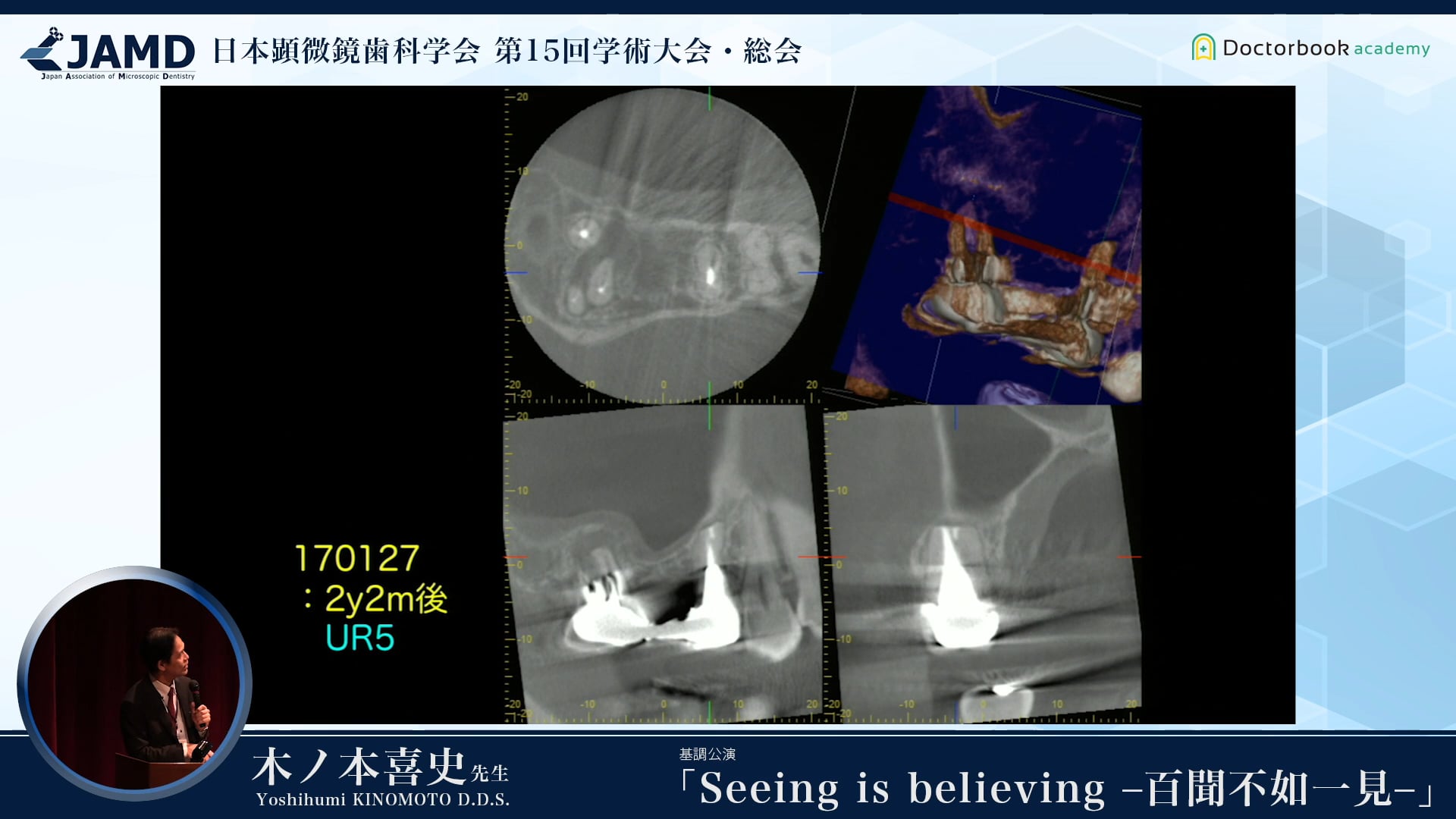 基調講演