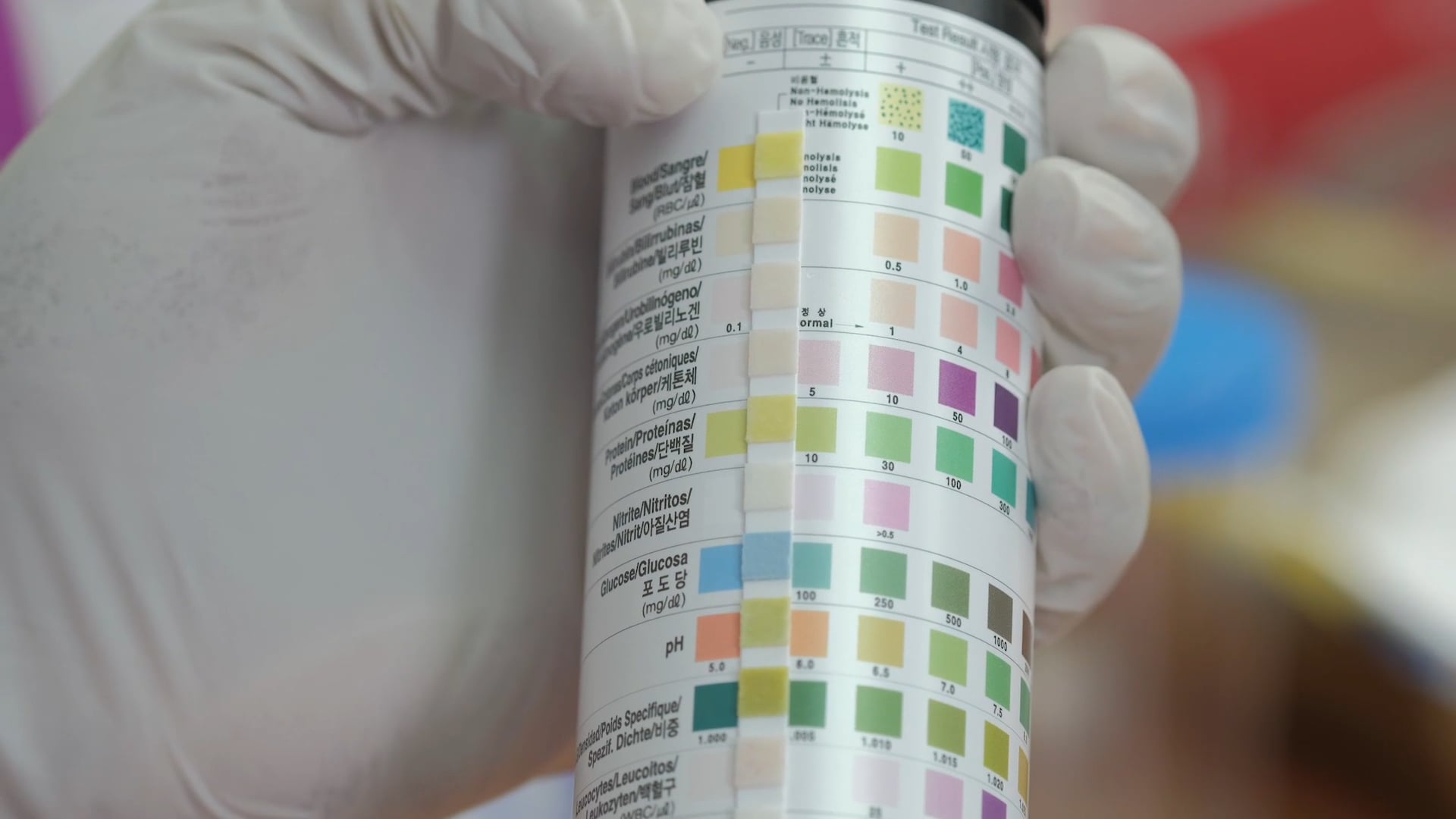 WHO PROTEINURIA & KETONURIA rough cut on Vimeo