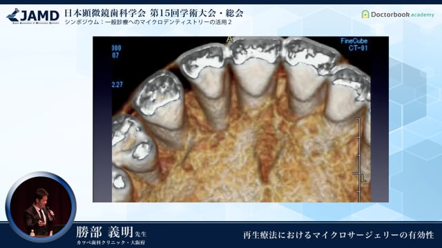 第15回 日本顕微鏡歯科学会 学術大会