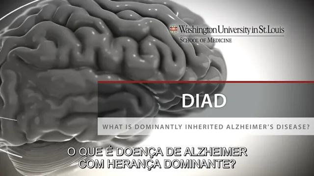 Doença de Alzheimer – Wikipédia, a enciclopédia livre