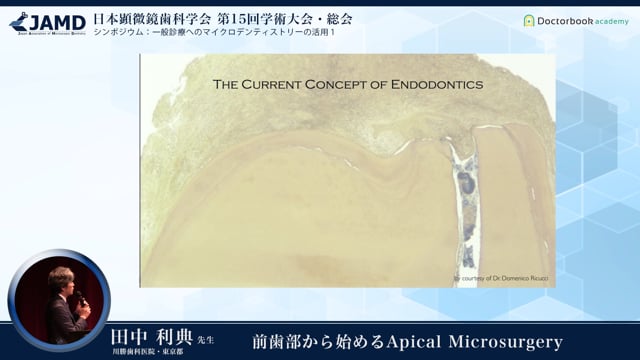 前歯部から始めるApical Microsurgery